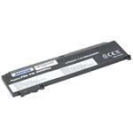 Náhradní baterie AVACOM Lenovo ThinkPad T460s Li-Pol 11,4V 2065mAh 24Wh